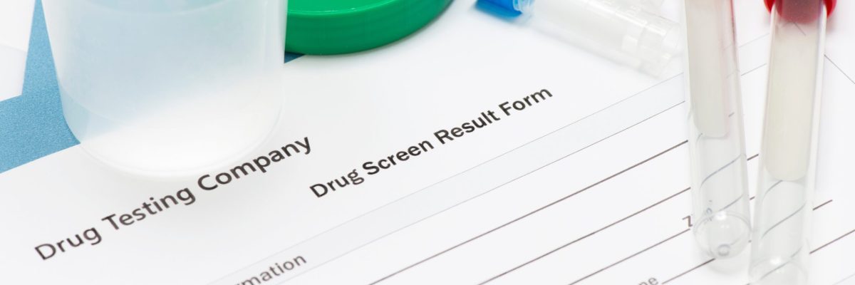 Drug screen results form with urine speciment container and blood and sputum specimen tubes.